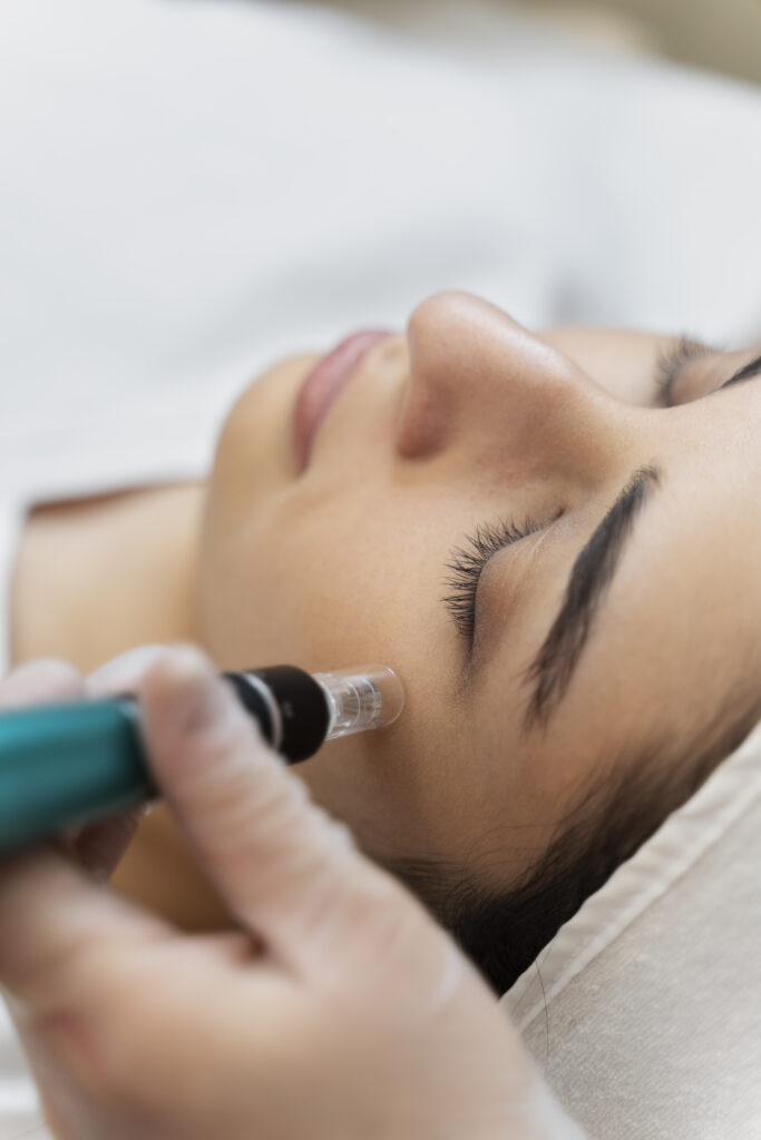 person getting micro needling beauty treatment